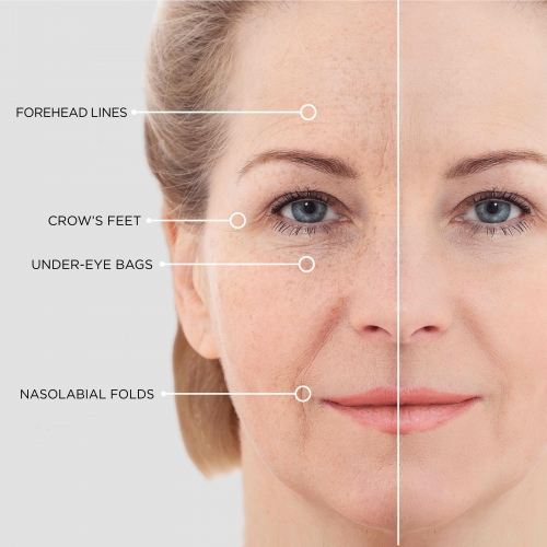 beautical instant lifting serum application