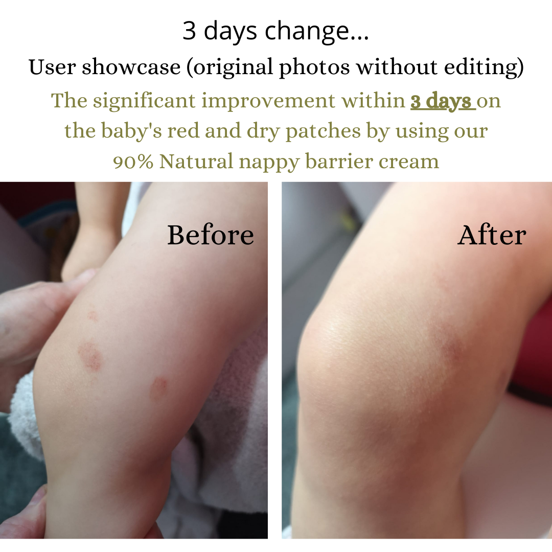 BEFORE after nappy cream